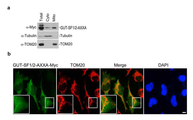 GUT-SF1/2 mutant (AXXA) 의 세포내 위치 관찰