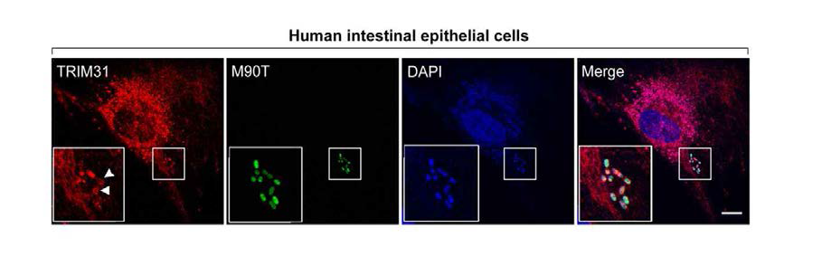 GUT-SF1/2(TRIM31)에 의한 shigella flexneri (M90T)의 colocalization 확인