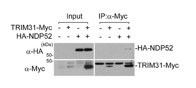 GUT-SF1/2(TRIM31)와 NDP-52의 상호결합 관찰