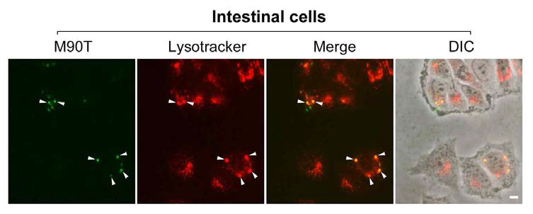 Shigella flexneri (M90T)의 lysosome localization 관찰 (lysotracker 이용)