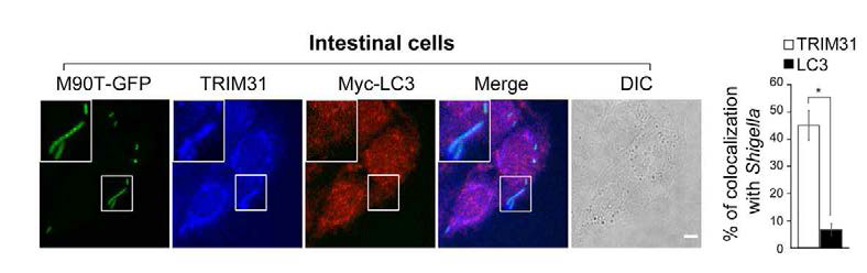 GUT-SF1/2(TRIM31)와 LC3의 Shigella flexneri (M90T)와의 colocalization 비교