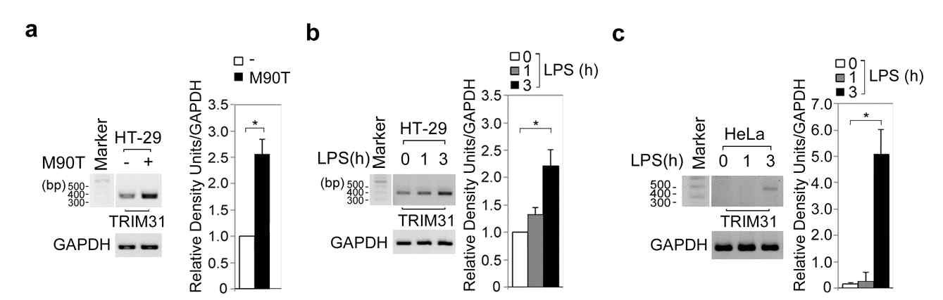 Shigella flexneri (M90T)와 LPS에 의한 GUT-SF1/2(TRIM31)의 발현량 분석