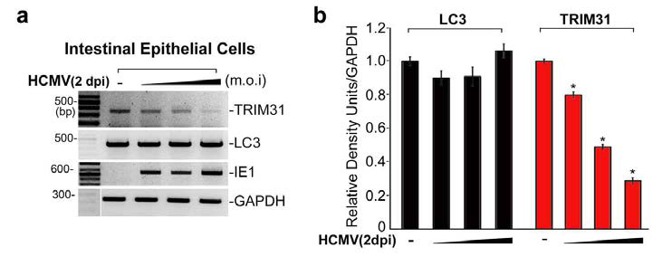 HCMV 감염에 의한 GUT-SF1/2(TRIM31)와 LC3의 발현량 비교 분석