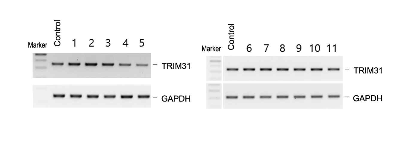 RT-PCR analysis를 통한 유산균에 의한 장내 면역밸런스 조절물질 TRIM31의 mRNA 발현 양상에 대한 관찰