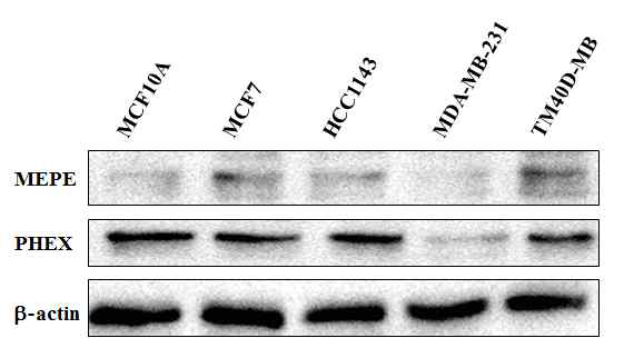 MEPE 및 PHEX 단백질 발현 분석