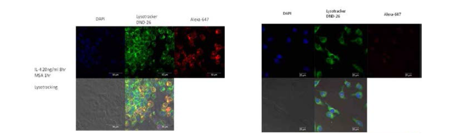 미세교세포로의 약물 전달 물질의 선택적 흡수와 CD206 블로킹을 통한 흡수 저해 확인