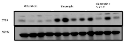 Bleomycin 및 BMT101을 투여한 폐 조직에서의 CTGF 단백질 발현량