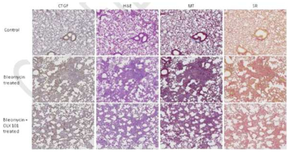 Bleomycin 및 BMT101을 투여한 폐 조직의 조직병리학적 분석