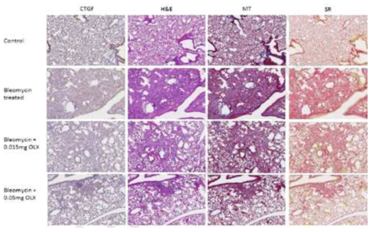 Bleomycin 및 BMT101을 투여한 폐 조직의 조직병리학적 분석