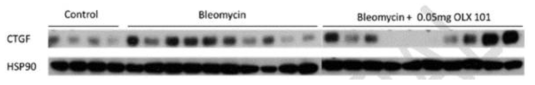 Bleomycin 및 BMT101을 투여한 폐 조직에서의 CTGF 단백질 발현량