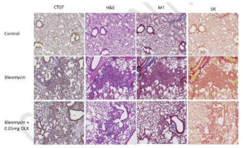 Bleomycin 및 BMT101을 투여한 폐 조직의 조직병리학적 분석
