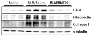 Bleomycin 및 BMT101을 투여한 폐 조직에서의 단백질 발현량