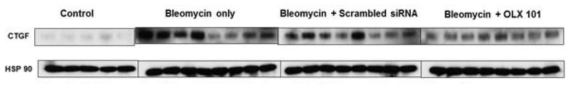 Bleomycin 및 Scrambled siRNA, BMT101을 투여한 폐 조직에서의 CTGF 단백질 발현량