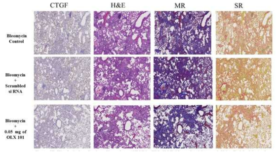 Bleomycin 및 BMT101을 투여한 폐 조직의 조직병리학적 분석
