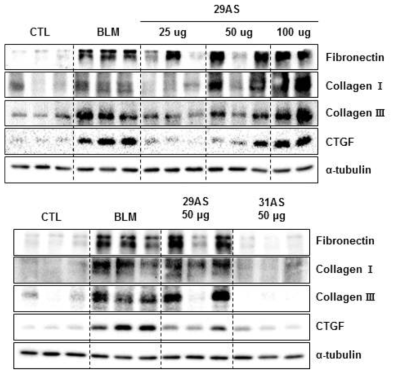 Bleomycin model에서 BMT101 (31AS) 과 BMT101 유도체 (29AS)의 fibrosis marker 억제 효력 비교 - protein level