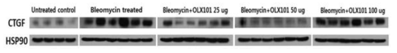 Bleomycin 및 BMT101을 투여한 폐 조직에서의 CTGF 단백질 발현량