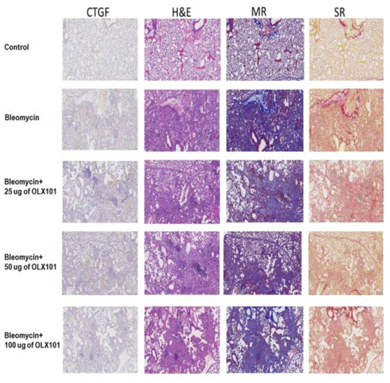 Bleomycin 및 BMT101을 투여한 폐 조직의 조직병리학적 분석