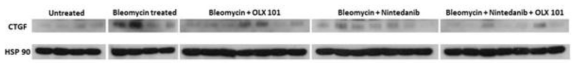 Bleomycin 및 BMT101, Nintedanib을 투여한 폐 조직에서의 CTGF 단백질 발현량