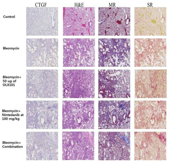 Bleomycin 및 BMT101, Nintedanib을 투여한 폐 조직의 조직병리학적 분석