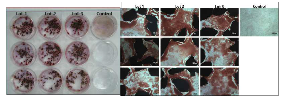 칼슘 침착 패턴 분석을 통한 이종골 지지체의 생체외 (in vitro) 유효성 평가; 좌: 배양접시의 염색사진, 우: 고배율로 염색의 패턴을 관찰