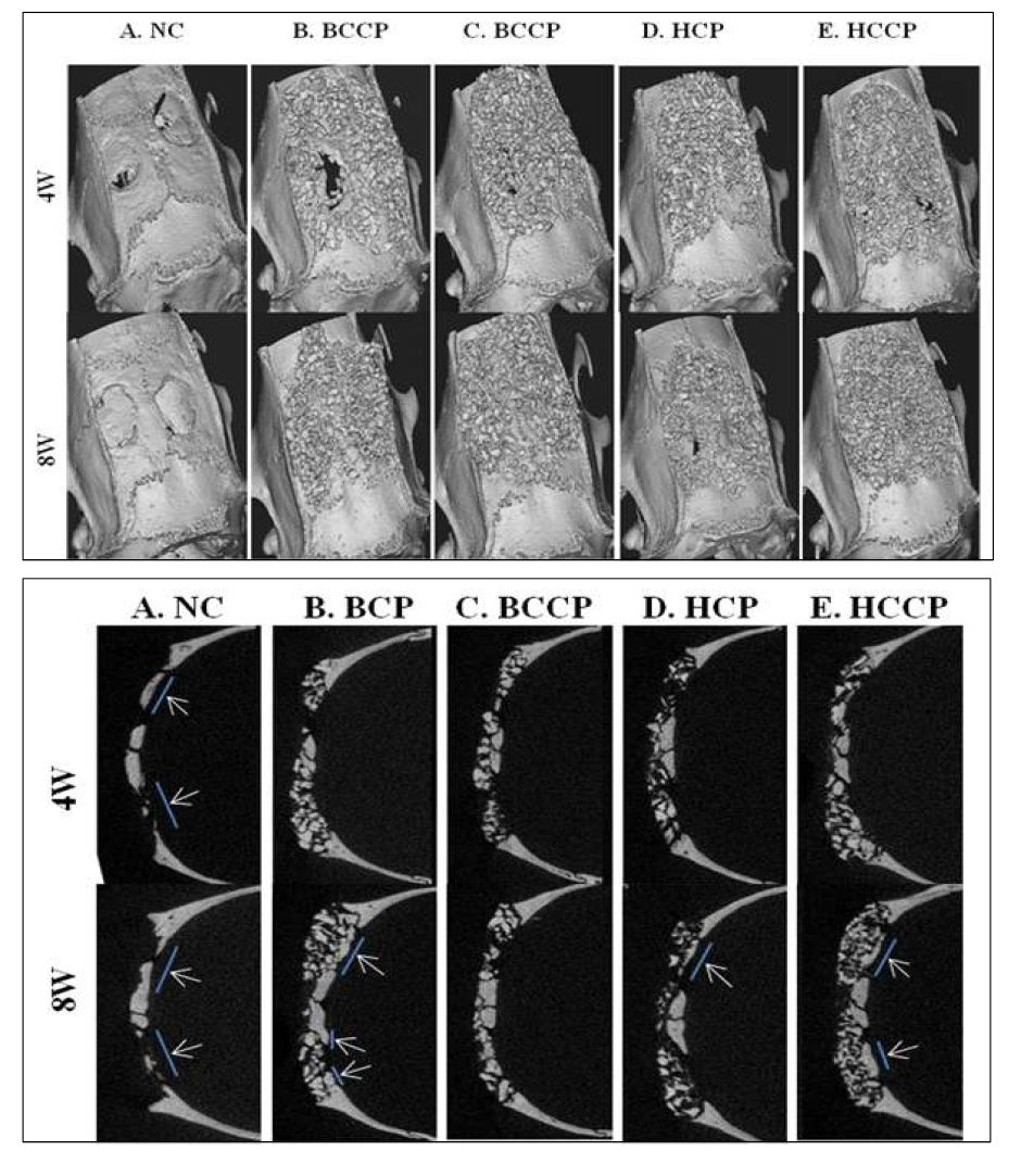 Cross section images of bone graft in rat defects. 골이식재가 이식된 랫드 결손부의 3차원 이미지와 절단면 이미지 사진으로 4주와 8주에 결손부에 신생골 (white arrow)이 형성된 것을 관찰하였음. (A : negative control, B : bovine cortical powder, C : bovine cortical cancellous powder, D : human cortical powder, E : human cortical cancellous powder)