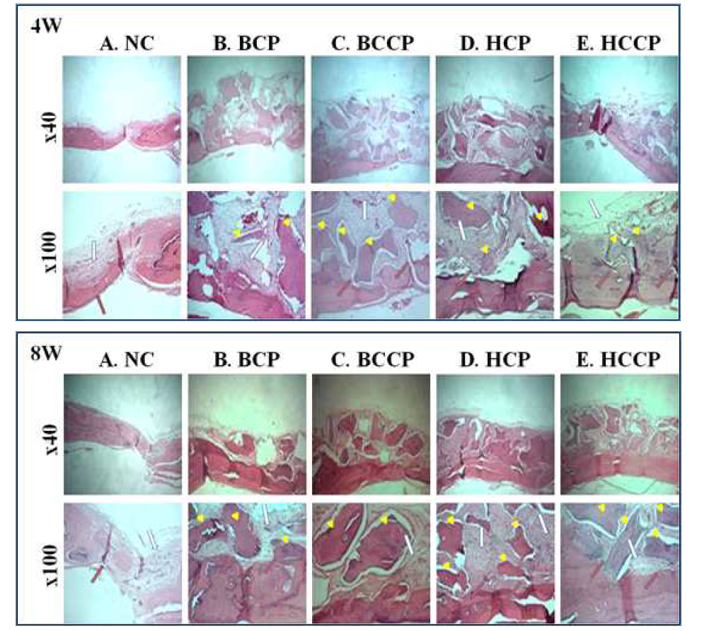 쥐 두개골 결손부의 이식 후 4주, 8주의 헤마톡실린-에오신 염색 단면 사진으로, 골이식재 (arrow head)와 섬유성 조직 (white arrow)의 범위가 줄어들며 신생골 (red arrow)의 범위가 전체적으로 증가. (A : negative control, B : bovine cortical powder, C : bovine cortical cancellous powder, D :human cortical powder, E : human cortical cancellous powder)