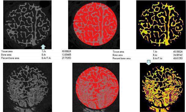 micro-CT 기반 신생골 부피 측정 프로세스