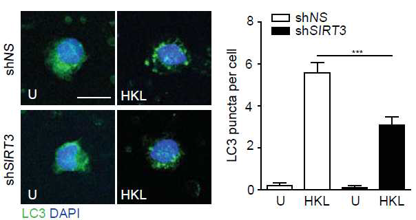 건강인 말초혈액 단핵구에서 SIRT3 knockdown에 의한 세포 내 honokiol에 의한 자가포식 단백질 LC3의 점상 패턴의 변화