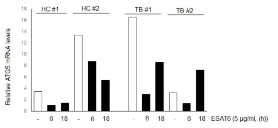 건강인과 결핵환자의 말초혈액 단핵세포에 대하여 ESAT6 항원 자극 후 자가포식 유전자인 ATG5 발현 비교