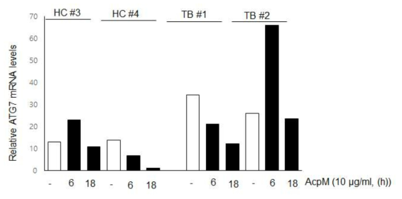 건강인과 결핵환자의 말초혈액 단핵세포에 대하여 AcpM 항원 자극 후 자가포식 유전자인 ATG8 발현 비교