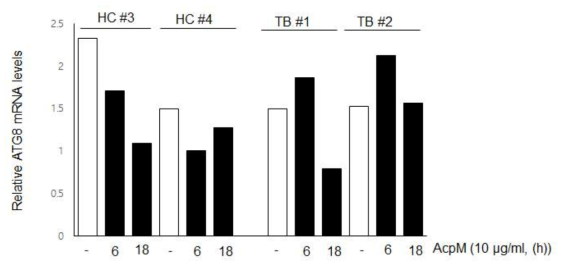 건강인과 결핵환자의 말초혈액 단핵세포에 대하여 AcpM 항원 자극 후 자가포식 유전자인 ATG8 발현 비교