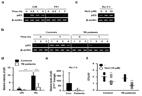 정상인 및 결핵환자의 분화된 큰포식세포에서 Nutlin3의 P53효과 분석