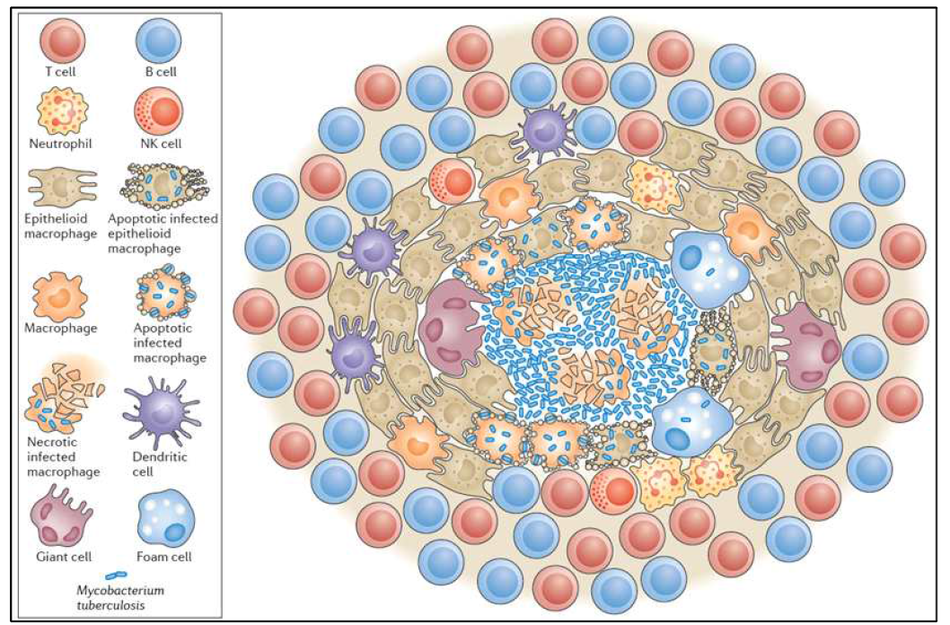 결핵균 감염 후 생성되는 육아종 모식도