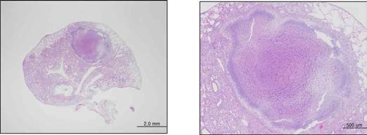 고병원성 결핵균 K균주 C3HeB/FeJ 마우스 감염 후 폐에서 관찰되는 건락성 육아종성 병변 (선행연구)