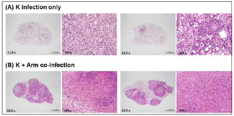 중증결핵모델에서 lung histopathology