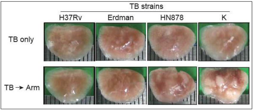 결핵 균주의 병원성 정도에 따라 형성되는 lung gross pathology