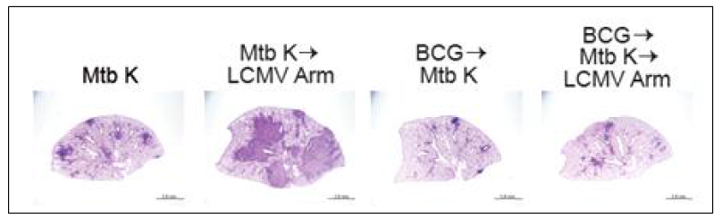 BCG 백신 처리 후 lung histophathology