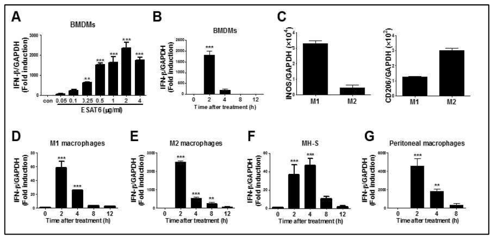 다양한 대식세포에서 ESAT6에 의한 IFN-β 유전자 발현