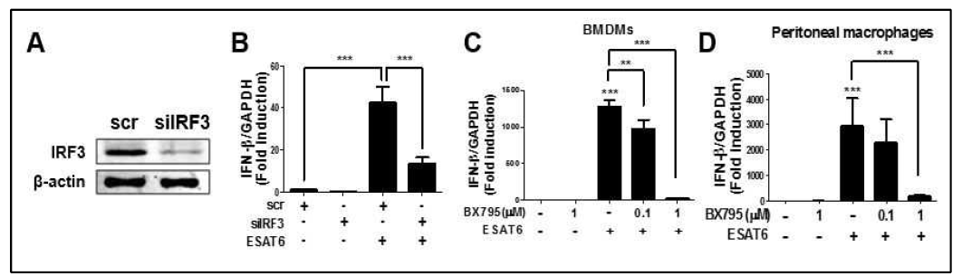 ESAT6에 의한 IFN-β 유전자 발현에서 TBK1과 IRF3의 관련성