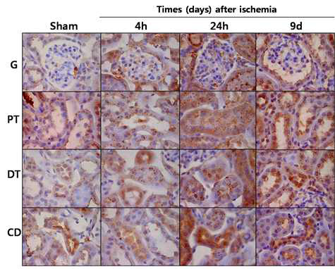 신장의 허혈/재관류 후 tubulin 탈아세틸화 효소, HDAC6의 발현 변화. G, glumerulus, PT, proximal tubule, DT, distal tubule and CD, collecting duct