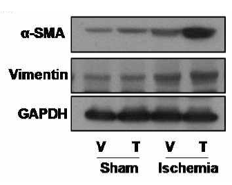 허혈/재관류 후 taxol 처리에 따른 섬유화 관련 단백질 발현 변화. 30분의 허혈/재관류 후 western blot을 이용하여 α-SMA과 Vimentin의 발현을 확인함