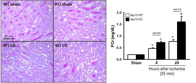 허혈/재관류 손상 후 Myeloid cell specific Sec10 knock-out 생쥐에서 신장 손상의 변화. Wild type과 Lyzcre-Sec10f/f 생쥐에 양측 신장에 25분의 허혈 후 재관류(I/R) 및 개복수술 (Sham)을 실시하였음. 수술 24시간 후 신장 조직을 고정하여 PAS 염색을 실시하였음. 수술 후 상기 시간에 혈중 크레아티닌 농도를 측정하였음. *, p<0.05; #, p<0.01 vs. respective sham