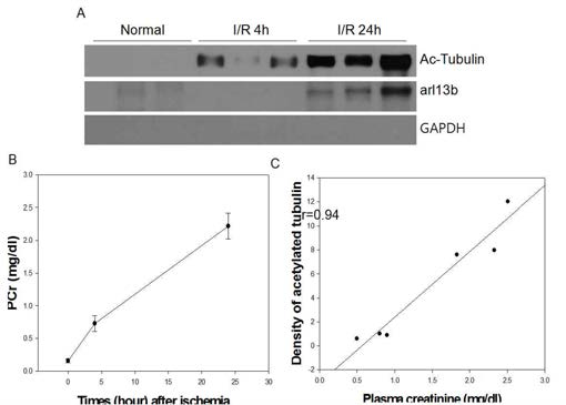 허혈/재관류에 의해 급성콩팥손상을 받은 생쥐의 소변에서 일차섬모 단백질의 검출. 생쥐의 콩팥의 혈관을 non-traumatic clamp로 30분간 결찰하여 허혈을 유발한 후 24시간 후에 (A) 소변을 받아 western blot을 시행하였음. (B) 허혈 후 24시간의 plasma creatinine (PCr) 농도. (C) PCr 농도와 urinary ac-tubulin 발현 양과의 비. Ac-tubulin의 양은 western blot에서 얻어진 blot의 density를 이용함