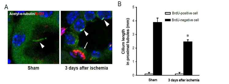 허혈/재관류 후 재생되는 콩팥 세뇨관세포에서 일차섬모 길이 변화. A) 생쥐 콩팥 허혈/재관류 손상 후 BrdU를 주입하여 재생되는 세포를 표시하고, 재생된 세포에서 일차섬모 확인. B) 재생된 세포에서 일차섬모의 길이 측정