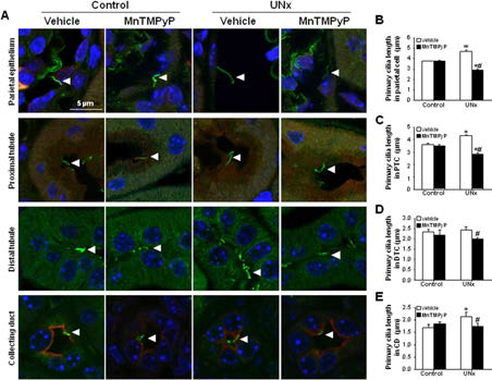 단측성 신장 절제술로 인한 신장 손상에 따른 일차섬모의 길이 변화. 단측성 신장절제 후 1일째에 MnTMPyP를 처리하여 9일 후 신장을 적출하여 일차섬모의 길이를 확인하였다. *p < 0.05 vs. respective-control., #p < 0.05 vs. UNx-vehicle on the same day