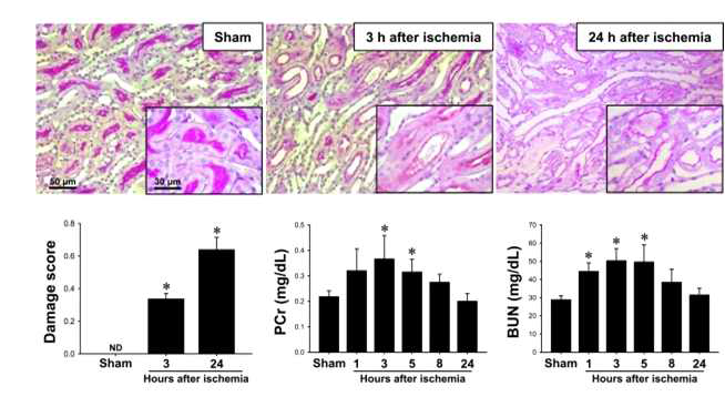 간 허혈/재관류 손상 후 신장의 형태적 기능적 변화. 생쥐는 60분 동안의 간 허혈 후 재관류를 실시함. 고정된 신장조직을 PAS 염색하였으며, 이를 분석하여 세뇨관 세포의 손상 정도를 그래프화 하였음. 기재된 시간의 혈중 크레아티닌, 혈중요소질소 농도를 측정함
