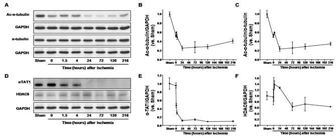 허혈/재관류 후 아세틸화 α-tubulin과 아세틸화 조절 단백질들(α-TAT, HDAC6)의 발현변화