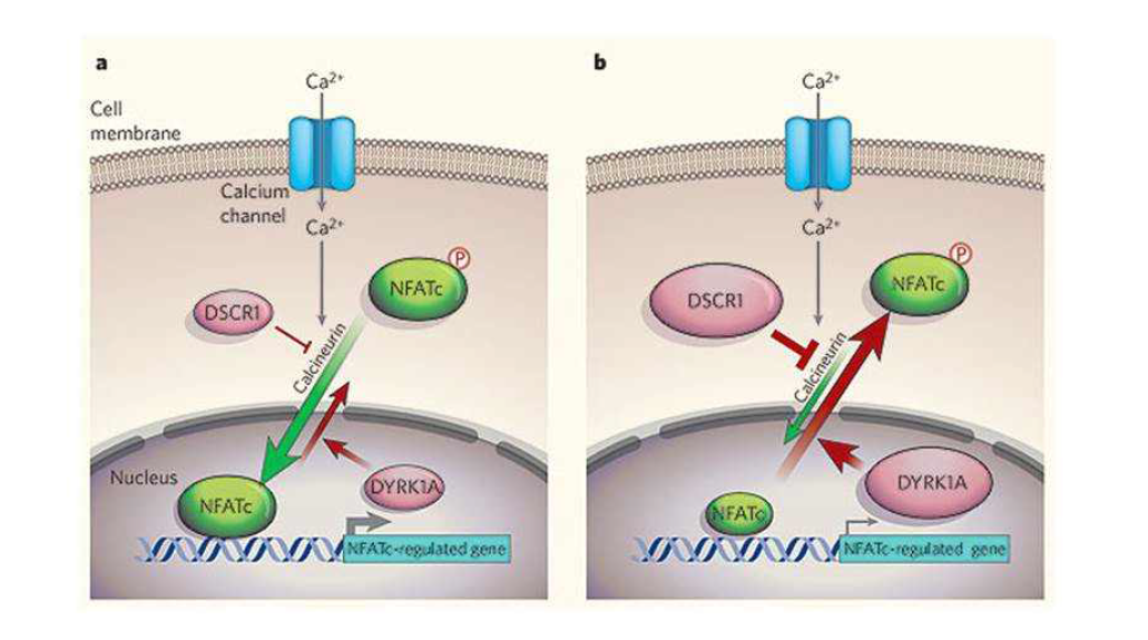 DYRK1A가 관여하는 NFAT 신호전달. calcium의 influx에 의해서 calcineurin이 활성화되면 NFATc가 탈인산화되면서 세포질에서 핵내로 이동해 전사인자로 작용하게 됨. DYRK1A가 과발현 된 조건에서는 NFATc가 다시 인산화되면서 핵내에서 세포질로 이동하게 되고 전사 활성이 감소하게됨