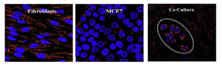 Mitochondrial staining (red). 단독 배양시 fibroblast에 mitochondriark 많고 MCF7 암세포에 mitochondria가 적다. Co-culture시 암세포내 mitochondria가 증가하며(원으로 표시), fibroblast에는 mitochondria가 감소하였다