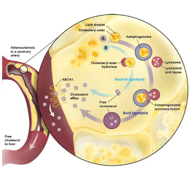 Cholesterol Efflux from Macrophage Foam cell via autophagy